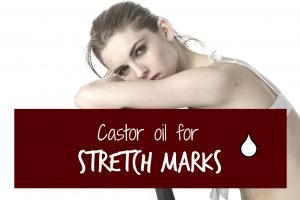castor-oil-for-stretch-mark-header