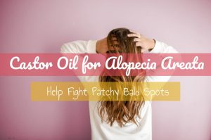 Castor Oil for Alopecia Areata | Castor Oil Guide