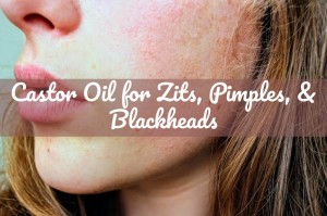 Castor Oil for Zits Pimples & Blackheads | Castor Oil Guide
