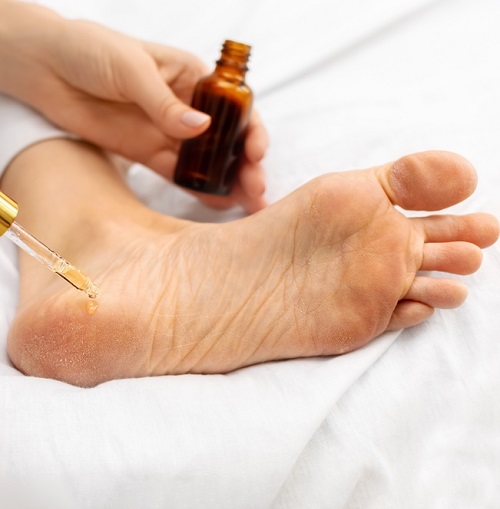 Oil For Foot Fungus