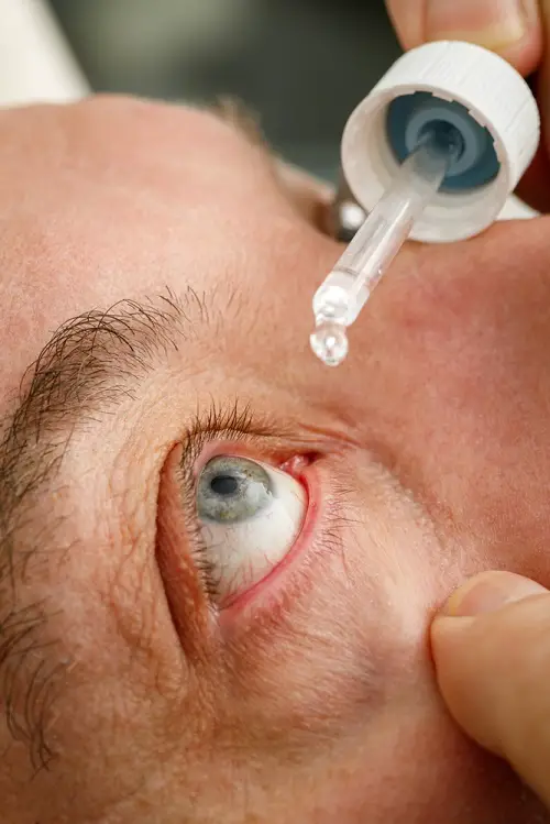 Use Castor Oil For Dry Eyes