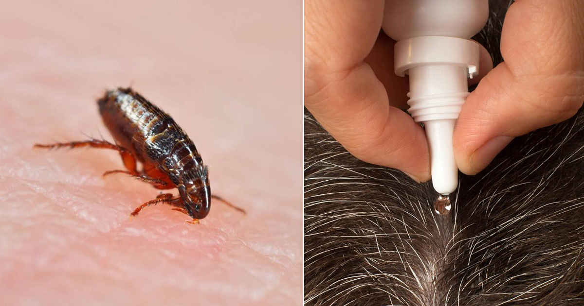 Tea Tree Oil for Fleas on Humans: Safe and Natural Treatment