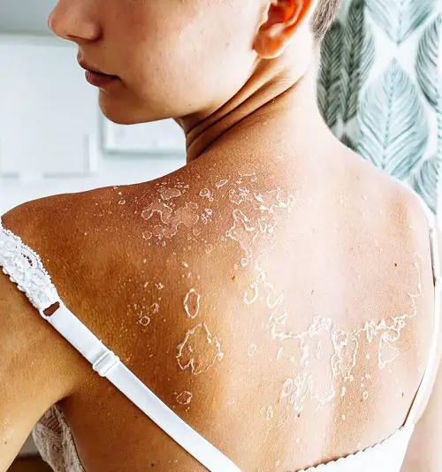 Helps Improve Dry Skin