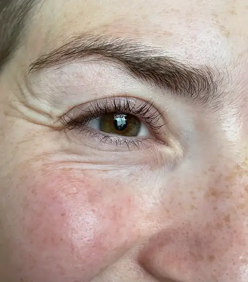 How To Use Castor Oil For Wrinkles 2