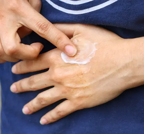 Helps Heal Wounds or Bug Bites