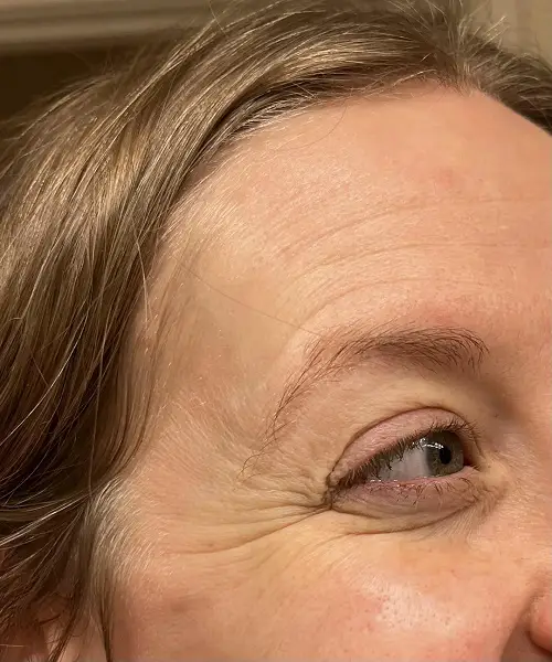 Aging Signs