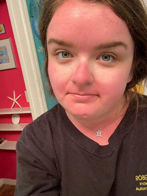 Benefits of Aloe Vera and Lemon Balm Face Mask Everyone’s Talking About 1