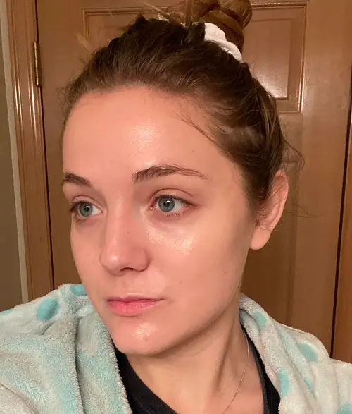 glow skin
