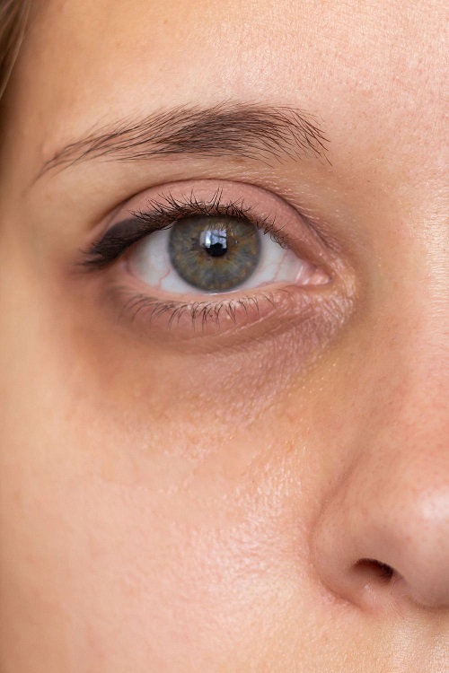 Banana Peel Beauty Hacks That Actually Work 2