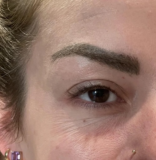 Wrinkles